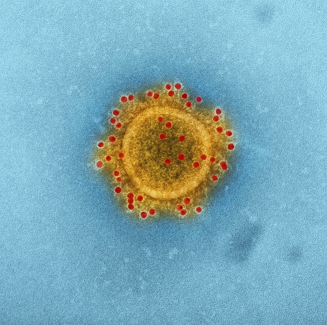 Coronavirus image