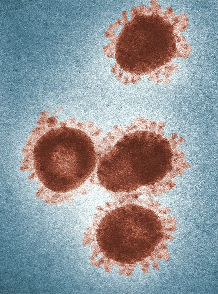 Coronavirus image